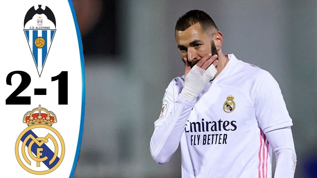 Karim Benzema covers his face next to Alcoyano's 2-1 scoreline against Real Madrid